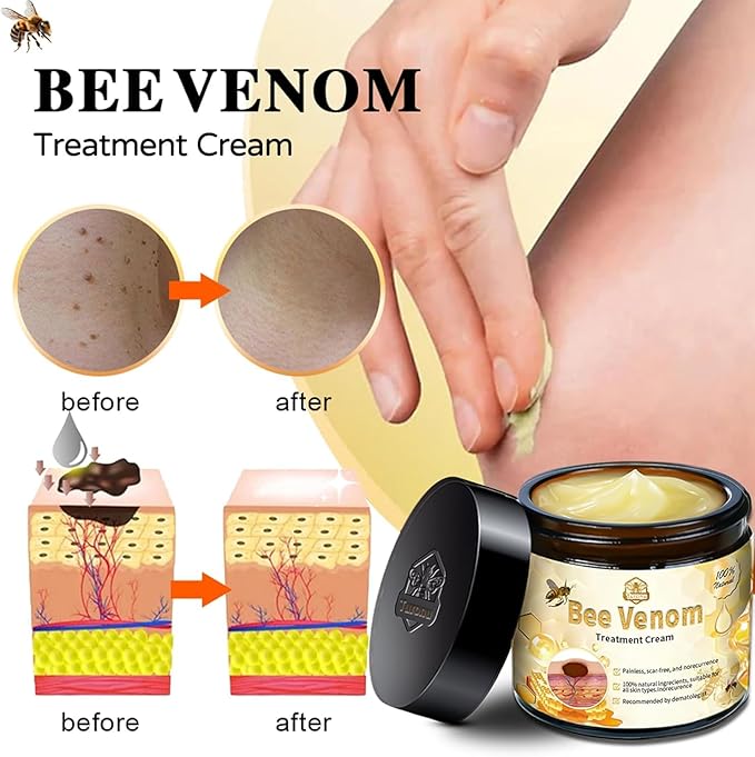 Bee Venom Skin Treatment Cream – Maximum Strength Repair (Pack of 2)