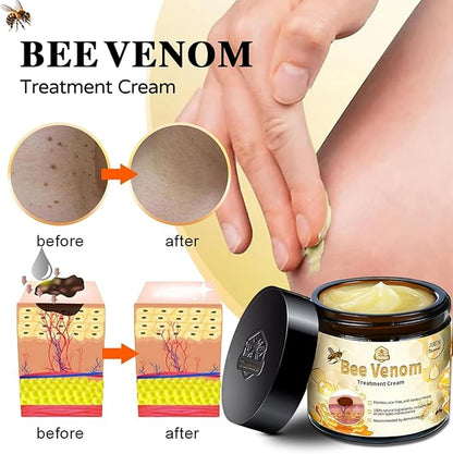 Bee Venom Skin Treatment Cream – Maximum Strength Repair (Pack of 2)