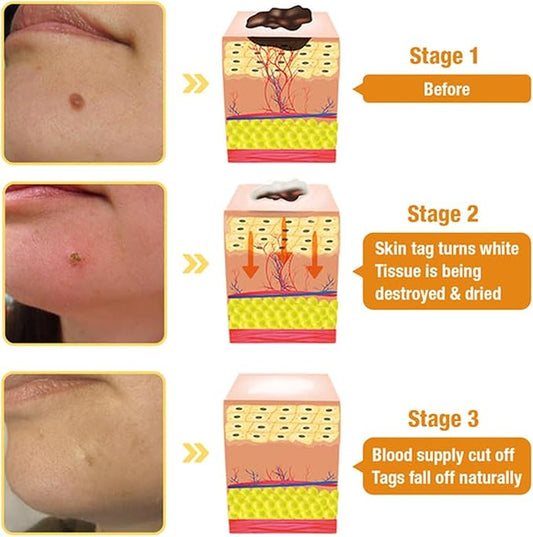 Bee Venom Skin Treatment Cream – Maximum Strength Repair (Pack of 2)